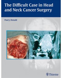 The Difficult Case in Head and Neck Cancer Surgery