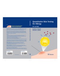 Quantitative Skin Testing for Allergy