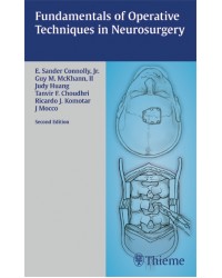 Fundamentals of Operative Techniques in Neurosurgery