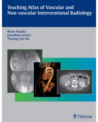 Teaching Atlas of Vascular and Non-vascular Interventional Radiology