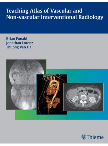 Teaching Atlas of Vascular and Non-vascular Interventional Radiology