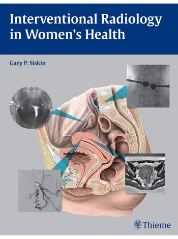 Interventional Radiology in Women's Health