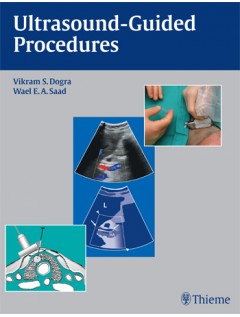 Ultrasound-Guided Procedures