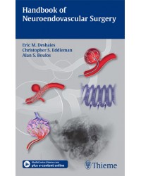 Handbook of Neuroendovascular Surgery