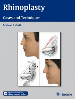 Rhinoplasty - Cases and Techniques