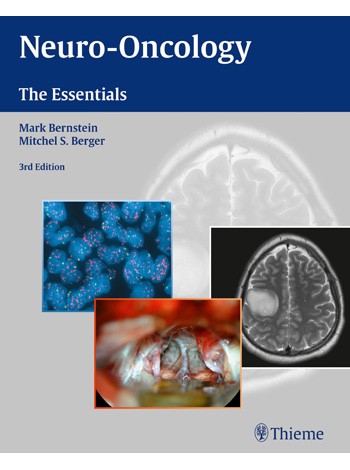 Neuro-Oncology: The Essentials