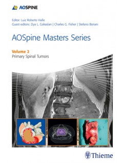 AOSpine Masters Series Volume 2: Primary Spinal Tumors