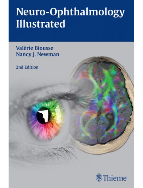 neuro ophthalmology illustrated free download