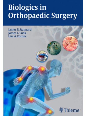 Biologics in Orthopaedic Surgery