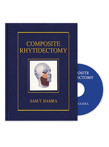 Composite Rhytidectomy