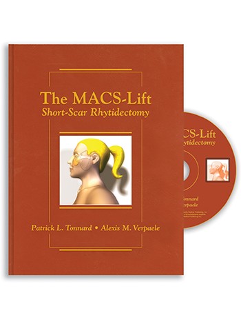 The MACS-Lift