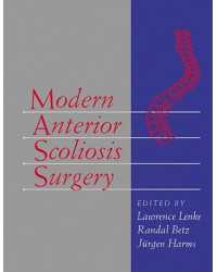 Modern Anterior Scoliosis Surgery