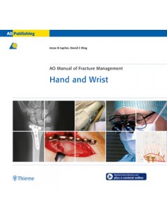 AO Manual of Fracture Management: Hand & Wrist