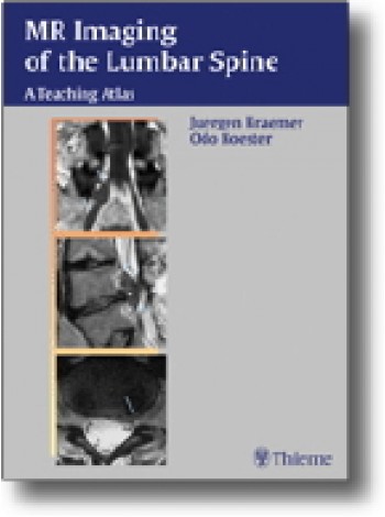 MR Imaging of the Lumbar Spine