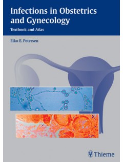 Infections in Obstetrics and Gynecology