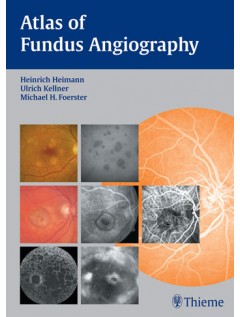 Atlas of Fundus Angiography