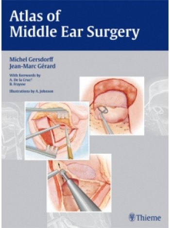 Atlas of Middle Ear Surgery