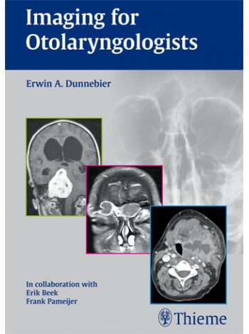 Imaging for Otolaryngologists