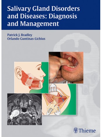 Salivary Gland Disorders and Diseases: Diagnosis and Management