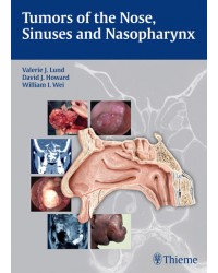 Tumors of the Nose, Sinuses and Nasopharynx