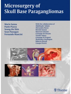 Microsurgery of Skull Base Paragangliomas