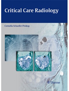 Critical Care Radiology