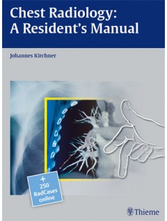 Chest Radiology: A Resident's Manual