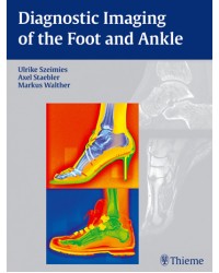 Diagnostic Imaging of the Foot and Ankle