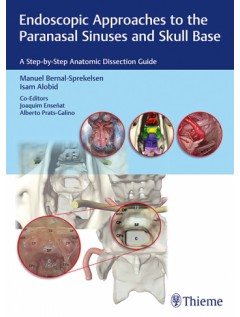 Endoscopic Approaches to the Paranasal Sinuses and Skull Base