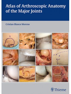 Atlas of Arthroscopic Anatomy of Major Joints