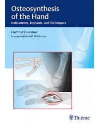 Osteosynthesis of the Hand