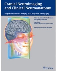 Cranial Neuroimaging and Clinical Neuroanatomy