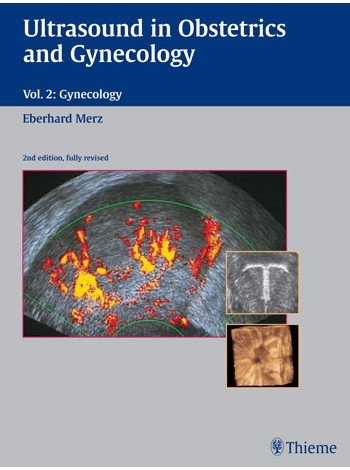 Ultrasound in Obstetrics and Gynecology, Volume 2 Gynecology
