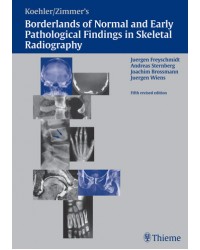 Koehler/Zimmer's Borderlands of Normal and Early Pathological Findings in Skeletal Radiography