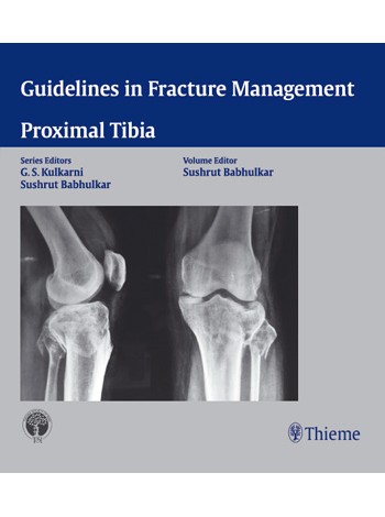 Guidelines in Fracture Management - Proximal Tibia