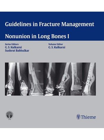 Guidelines in Fracture Management - Nonunion in Long Bones I