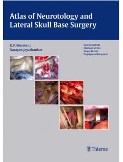 Atlas of Neurotology and Lateral Skull Base Surgery