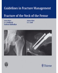 Guidelines in Fracture Management
