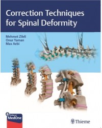 Correction Techniques for Spinal Deformity
