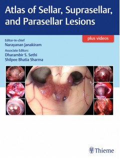 Atlas of Sellar, Suprasellar and Parasellar Lesions