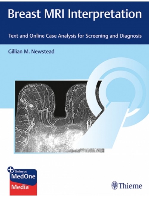 RadiologyBreast MRI Interpretation