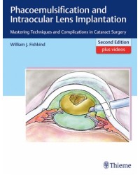  Phacoemulsification and Intraocular Lens Implantation