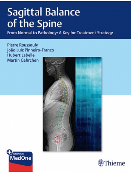 Spine Surgery L Sagittal Balance Of The Spine