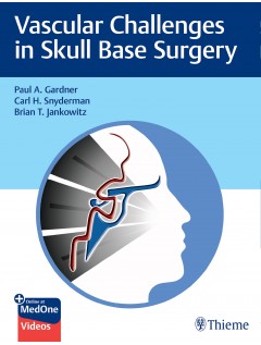 Vascular Challenges in Skull Base Surgery