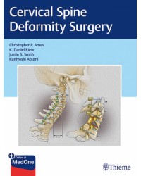 Cervical Spine Deformity Surgery
