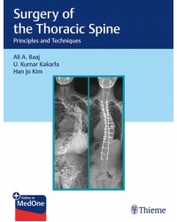 Surgery of the Thoracic Spine