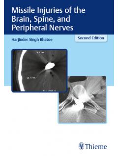 Missile Injuries of the Brain, Spine, and Peripheral Nerves