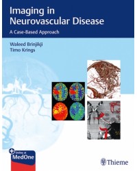 Imaging in Neurovascular Disease