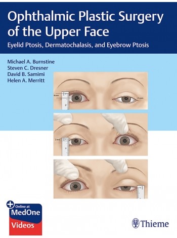 Ophthalmic Plastic Surgery of the Upper Face