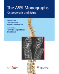 The ASSI Monographs Osteoporosis and Spine